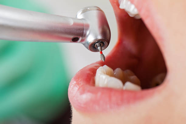 Best Mobile Emergency Dentist in Wrightsville, GA